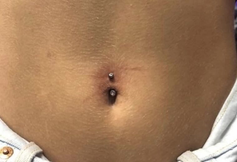 Navel piercing by San Diego Piercing Company